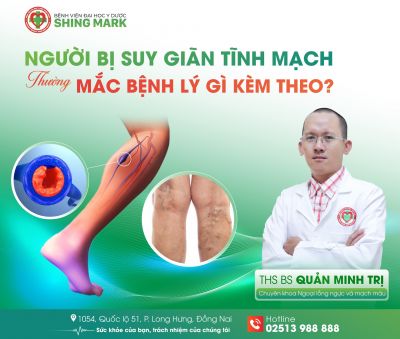 NGƯỜI BỊ SUY GIÃN TĨNH MẠCH THƯỜNG MẮC BỆNH LÝ GÌ KÈM THEO?