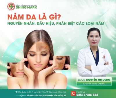 NÁM DA LÀ GÌ? NGUYÊN NHÂN, DẤU HIỆU VÀ CÁCH PHÂN BIỆT CÁC LOẠI NÁM