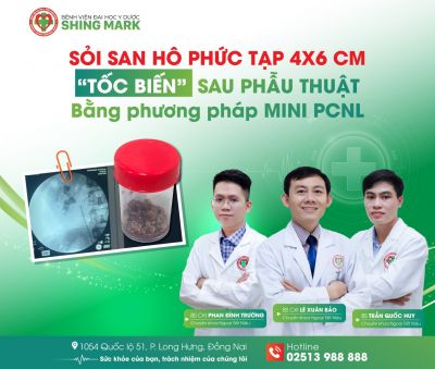SỎI SAN HÔ PHỨC TẠP 4X6 CM “TỐC BIẾN” SAU PHẪU THUẬT BẰNG PHƯƠNG PHÁP MINI PCNL