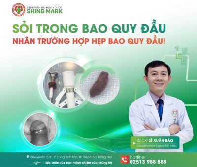 PHÁT HIỆN SỎI TRONG BAO QUY ĐẦU – TRƯỜNG HỢP HIẾM GẶP TỪ HẸP BAO QUY ĐẦU