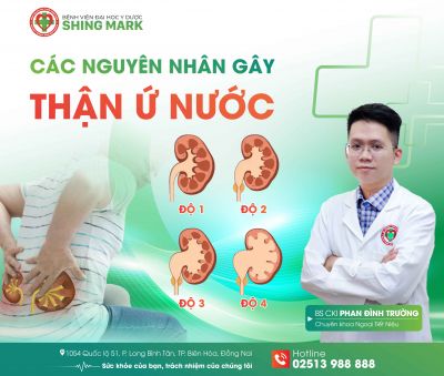 NGUYÊN NHÂN GÂY THẬN Ứ NƯỚC