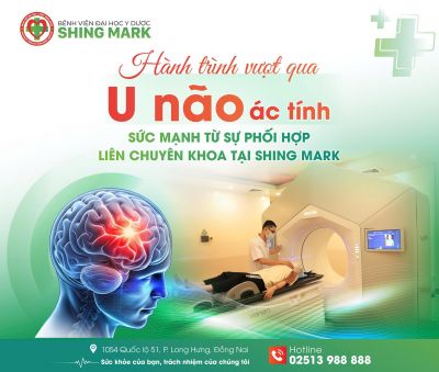 HÀNH TRÌNH VƯỢT QUA U NÃO ÁC TÍNH: SỨC MẠNH TỪ SỰ PHỐI HỢP LIÊN CHUYÊN KHOA TẠI SHING MARK