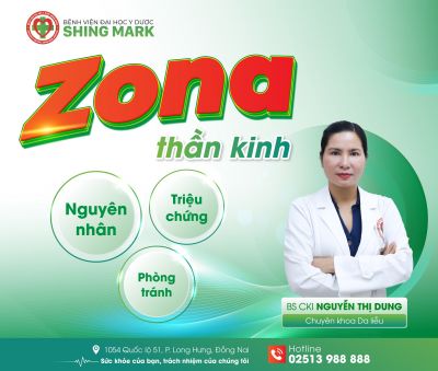 BỆNH ZONA