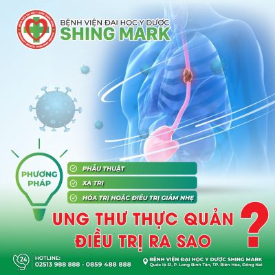 UNG THƯ THỰC QUẢN ĐIỀU TRỊ RA SAO?