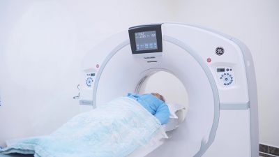 CT MẠCH VÀNH: BƯỚC ĐỘT PHÁ TRONG CHẨN ĐOÁN TIM MẠCH