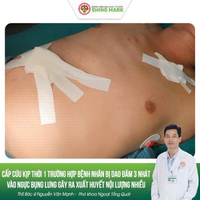 CẤP CỨU KỊP THỜI 1 TRƯỜNG HỢP BỆNH NHÂN BỊ DAO ĐÂM 3 NHÁT VÀO NGỰC BỤNG LƯNG GÂY XUẤT HUYẾT NỘI LƯỢNG NHIỀU